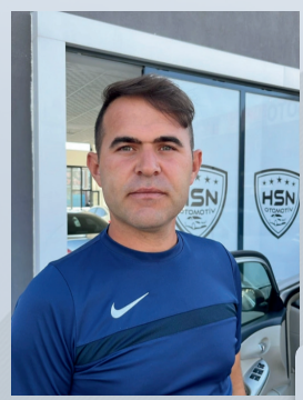 After hair transplant