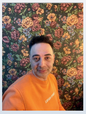 After hair transplant